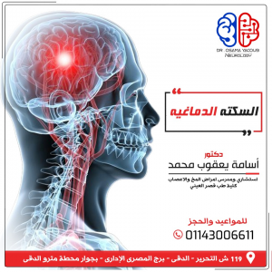 السكتة الدماغية
